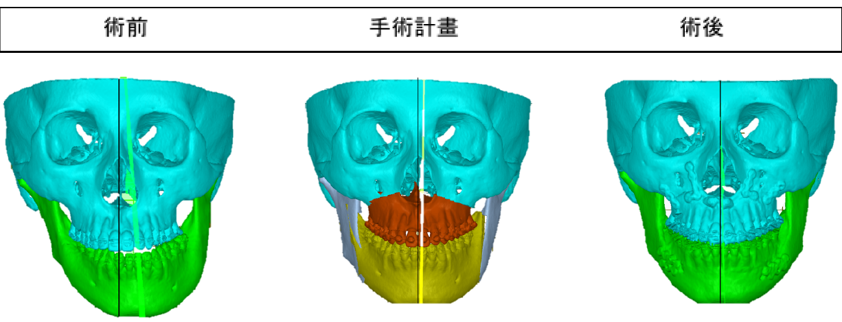 圖1